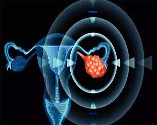 检查精子质量需要做哪些检查