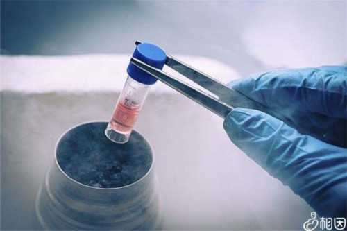 y精子适合在什么环境?y精子适不适合在酸性环境生存?