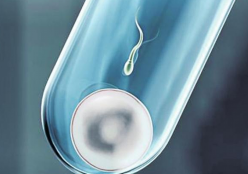 月经不规律如何调理