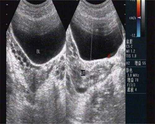 孕妇碱性磷酸酶300多严吗