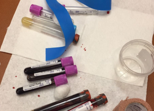 「孕酮低怎么办」孕酮卵泡期0.15x1.40是什么意思