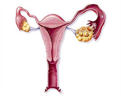 代生中介机构-生子以后选择月子中心有什么优势