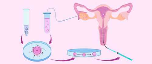 孕早期hcg翻倍速度