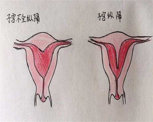 6一7周孕囊大小看是男是女，6-7周孕囊形状看是男是女