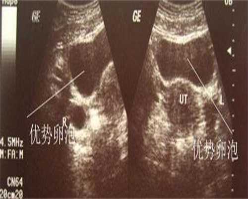 囊胚级别成功率对照表?囊胚等级不是唯一因素