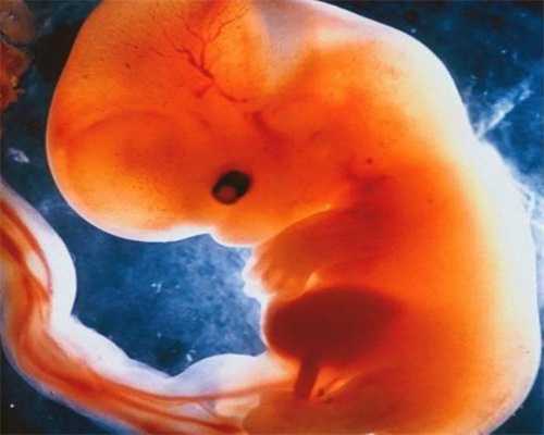 hcg低的胎儿健不健康看孕期hcg动态变化规律，都花在哪了！